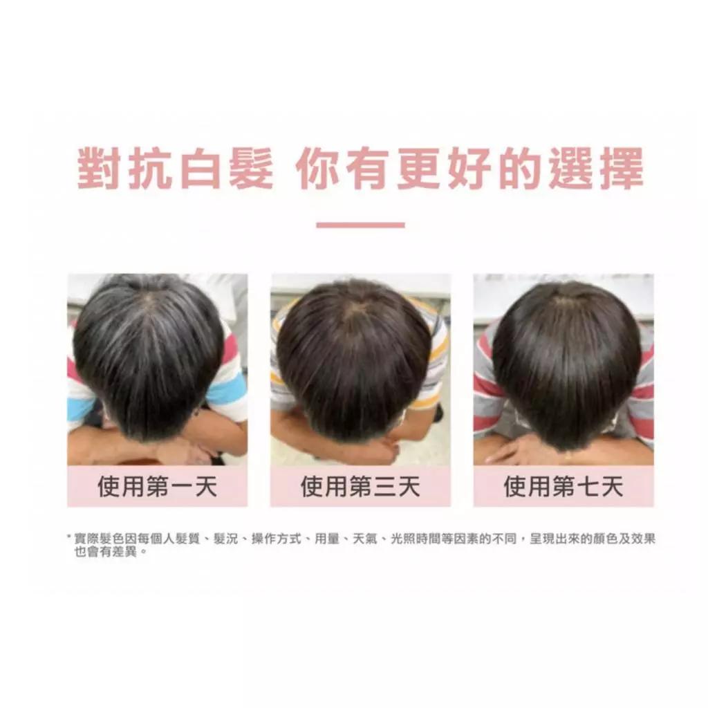 my-11134207-7r98o-lpl0s739nvdmf5