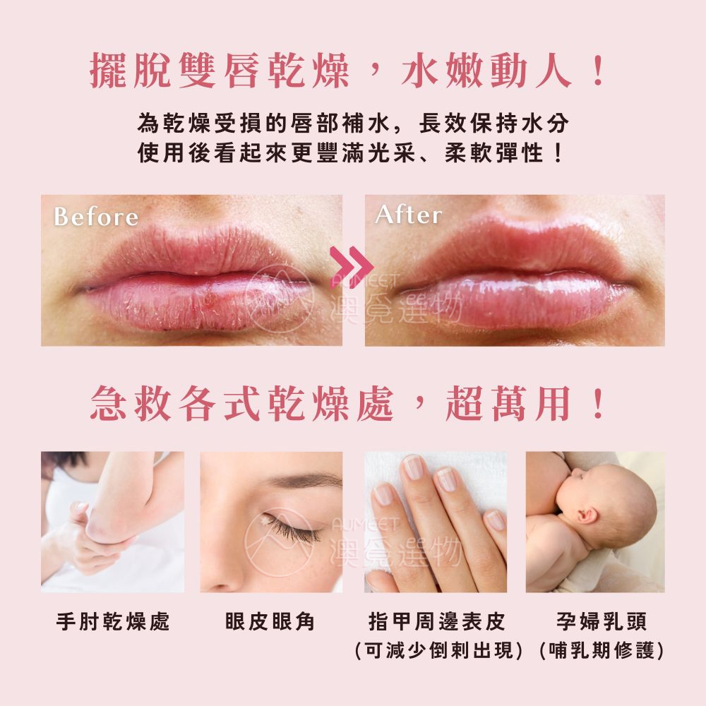 LINE_ALBUM_AM圖文｜Lanolips_251224_4