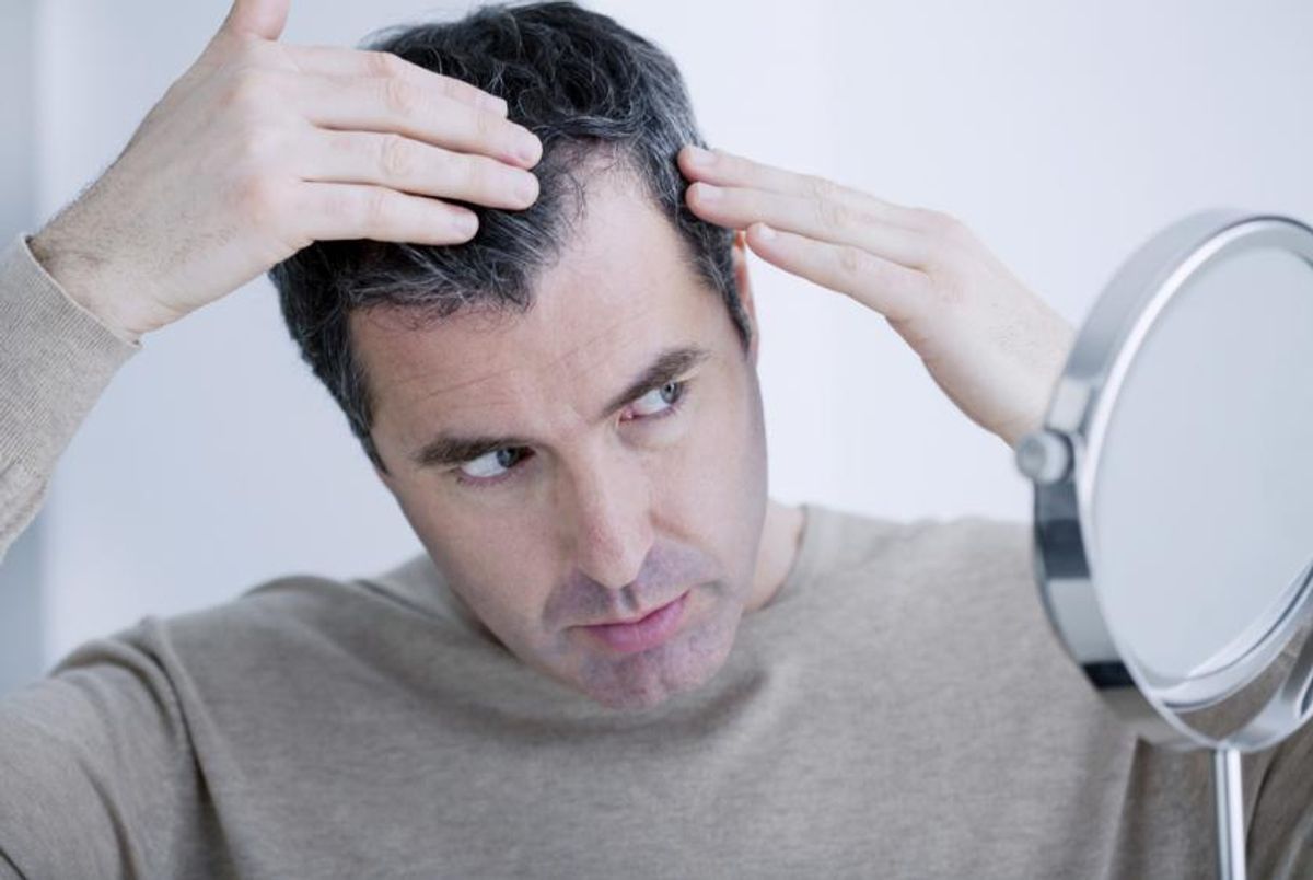7 Sebab Kehilangan Rambut Di Kalangan Orang Dewasa
