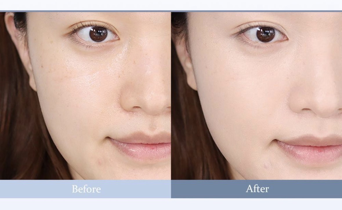 image_3C4F4E89-2A2A-475B-A43F-E2BEFCF5268F_1772303495