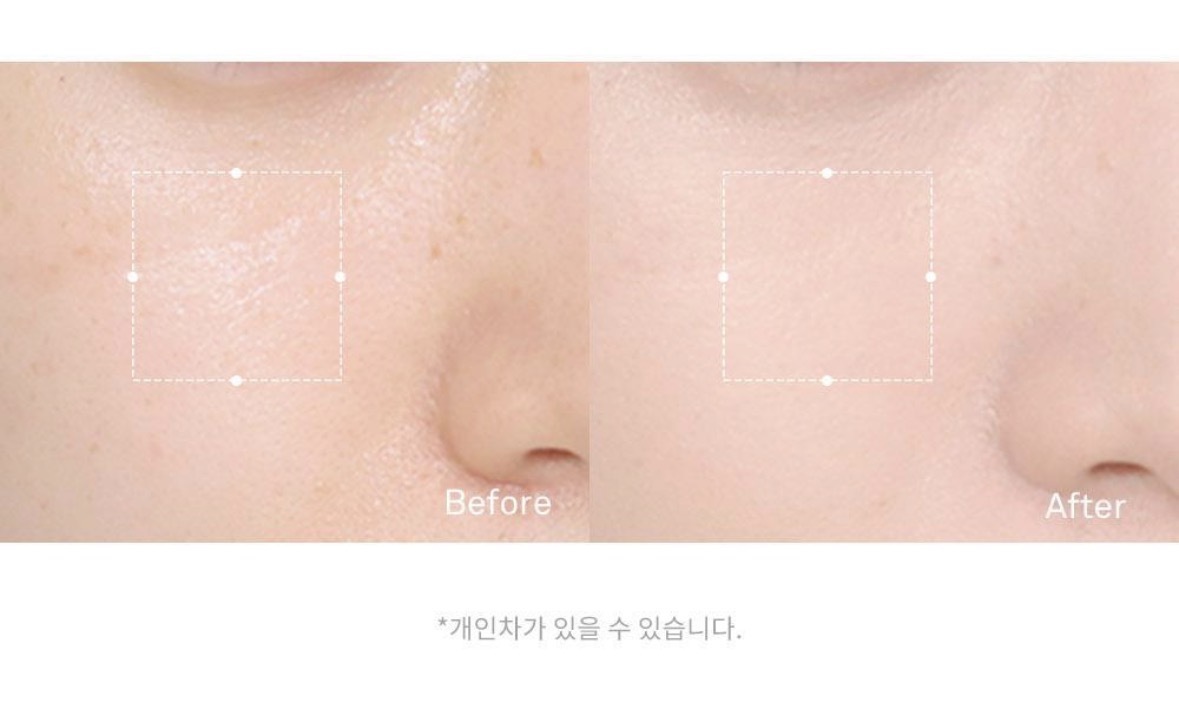 image_946EE36D-451C-4C12-9AD1-73F1C6A88D9C_1772303495