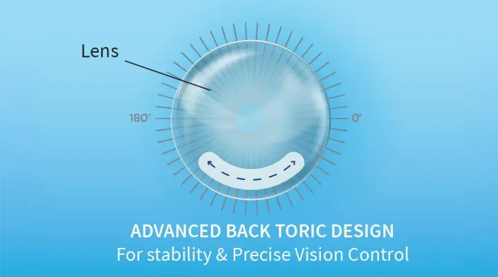 Advanced-Toric