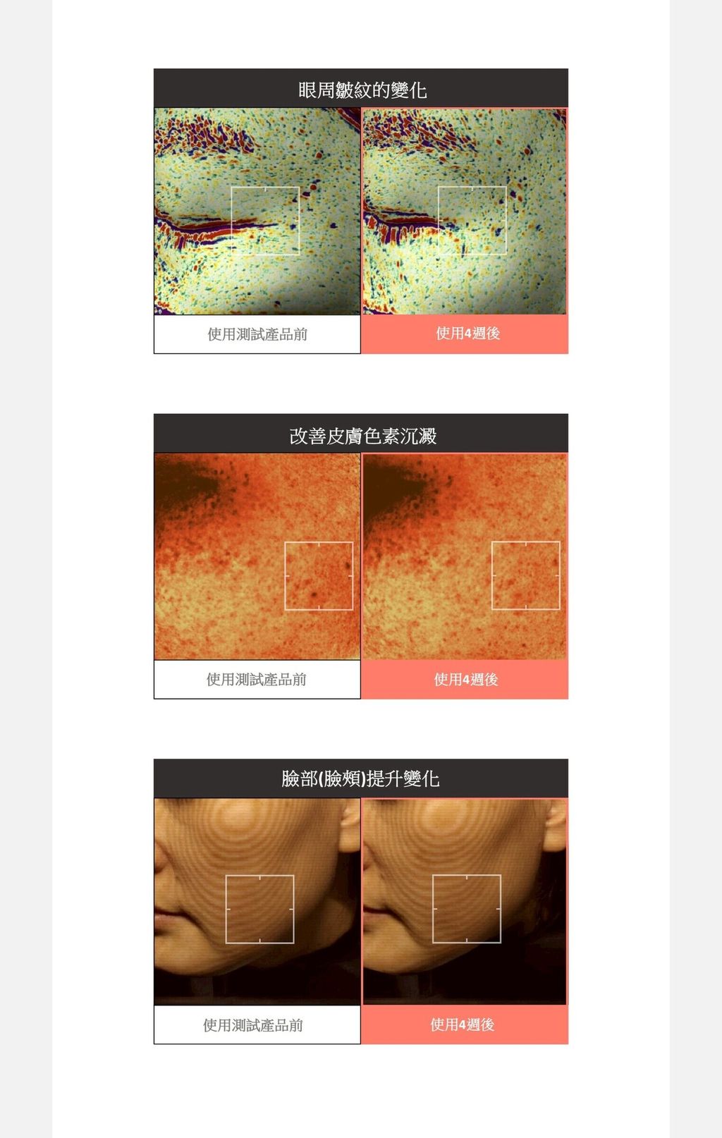 修復霜5-2-2