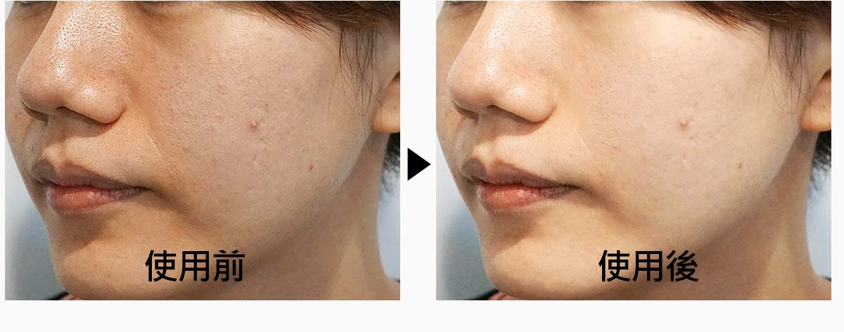 29081575-D821-4187-8655-887AFECF8596