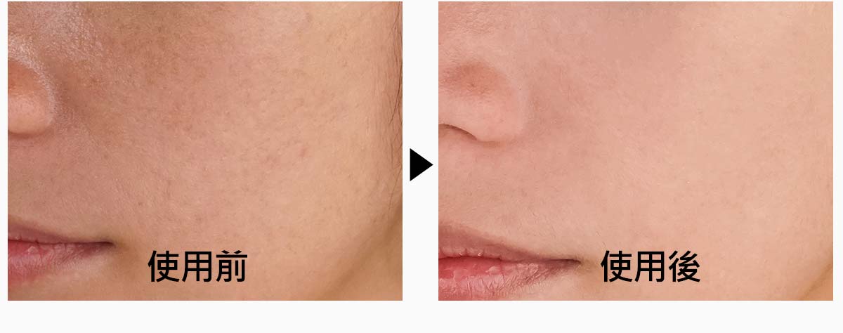 F28F77EF-DBAD-44FC-B125-D518D1FAB419