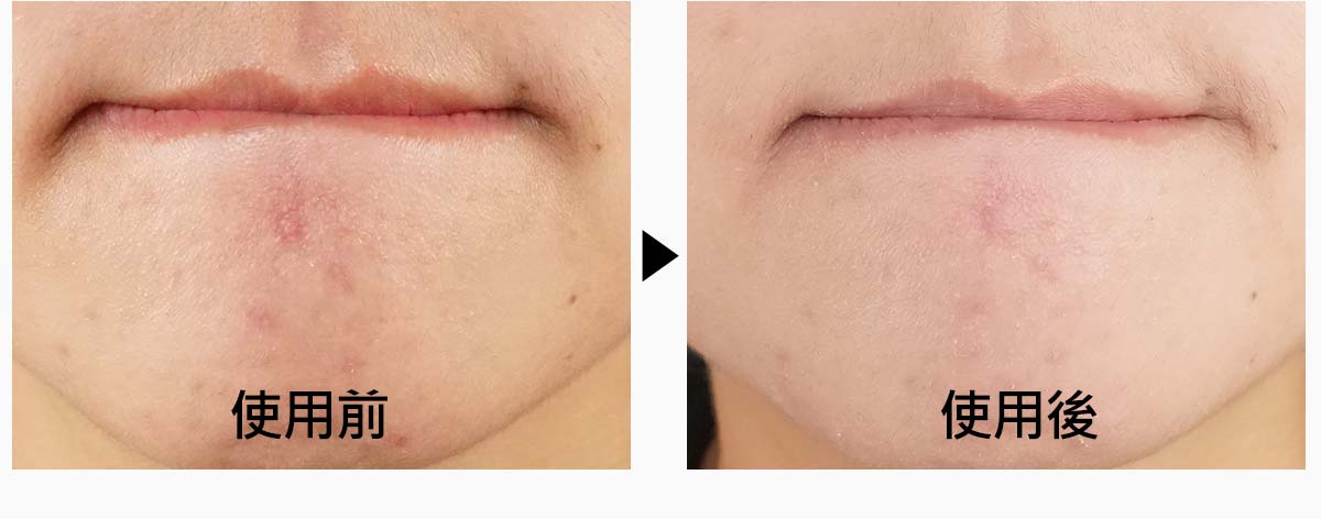 31B26036-1F7E-4175-91F7-002BFD428E8E