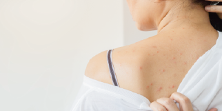 冬季肌膚的溫柔守護：從補水到屏障的深度修護