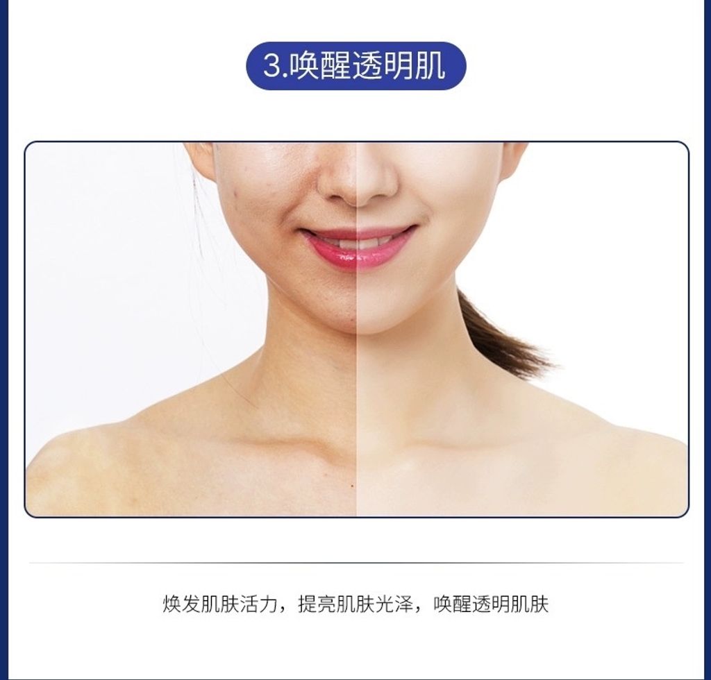 ZlpUVIr6sH7NdSIE1nrYeoBYoJlNTHF8x39eye9O