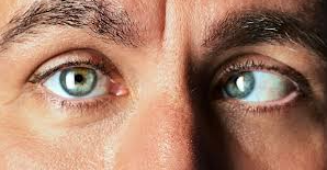 Strabismus (Crossed Eyes) boy optical shop online contact lens man