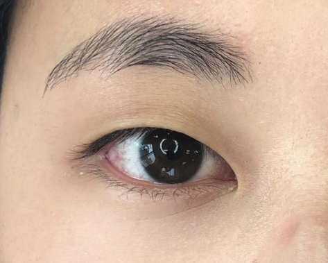 Your Eye shape and contact lens that suits best optical retail optometrist online shop contact lens monolids