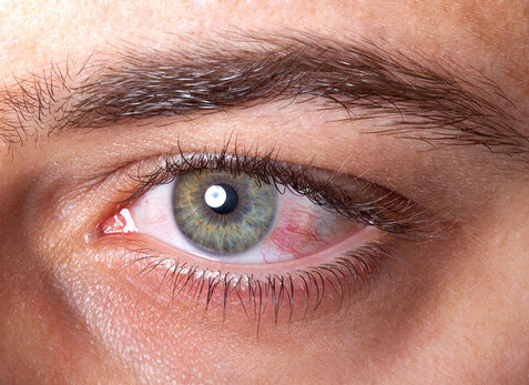 Why do contact lens get blurry contact lens sale near me optical red eyes