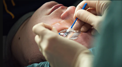 Can LASIK fix Astigmatism best optical shop retail near me contact lens eye surgery