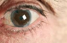 Diabetic retinopathy online contact lens shopping near me optical shop retail malaysia eyes