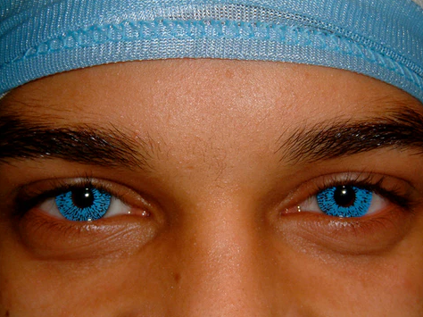 Common contact lens problem and their solution best online optical shop near me malaysia blue eyes