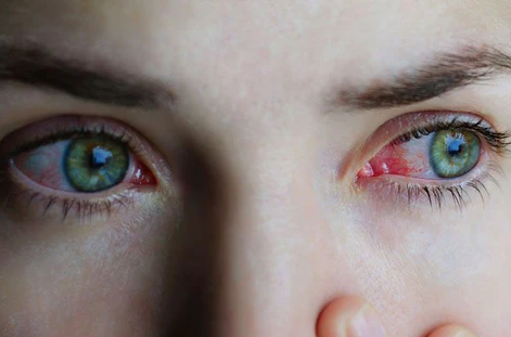 What's causing my eyes watery best optical shop near me sale price online contact lens malaysia red eyes