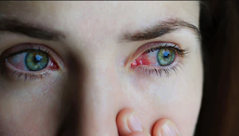Rules Of Wearing A Contact Lenses top optical shop near me online lens best prices malaysia red eyes
