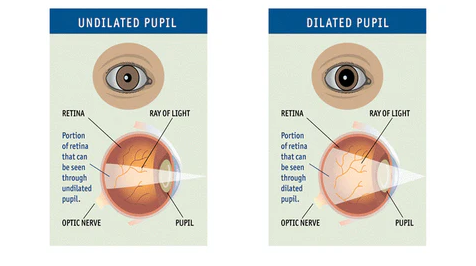 Get To Know Your Eyes Better top malaysia optical shop retail near me online contact lens eye diagram