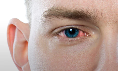 When The Contact Lens Needs To Be Removed top malaysia optical shop retail near me online contact lens wash hands malaysia red eyes
