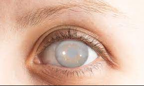 Eye Care Myths top optical shop near me best online contact lens sale prices malaysia free shipping eyes