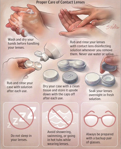 Useful Tips for Everyone Who Wears Contact Lenses top malaysia optical shop retail near me online contact lens wash hands malaysia diagram