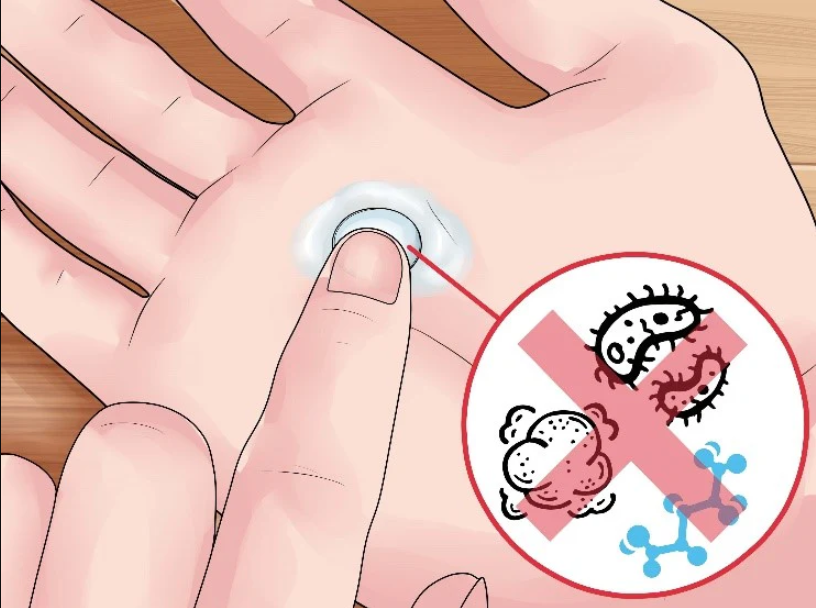 Useful Tips for Everyone Who Wears Contact Lenses