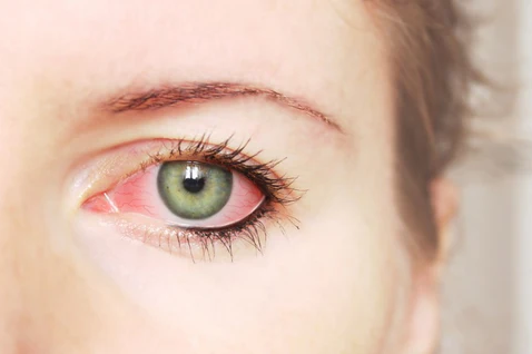 How long can I wear my contacts top malaysia online shop retail for contact lens best prices sale eye drops red eyes