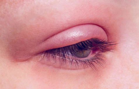 3 top reason you are not suitable for contact lenses top malaysia online shop retail for contact lens best prices sale eye infection