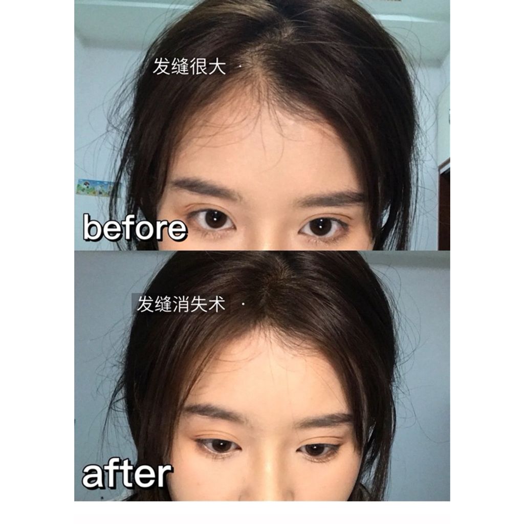 tw-11134207-7r98w-lvoklzu8tyafea