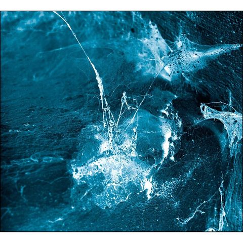 d57993baecda474bc3d8234e7c8da22c