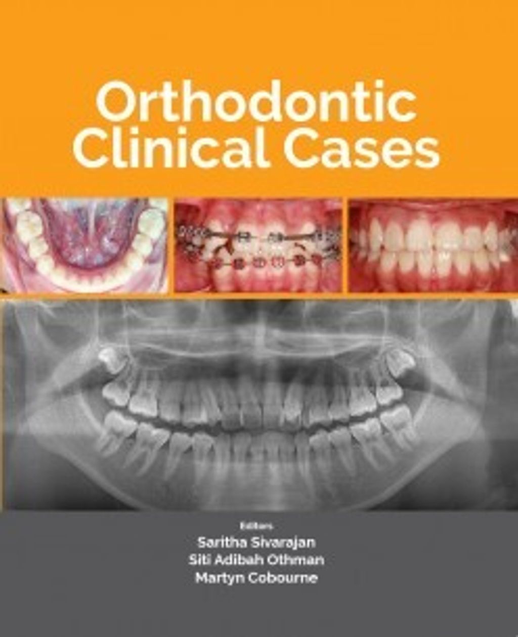 Orthodontic_Clinical_Case-305x305
