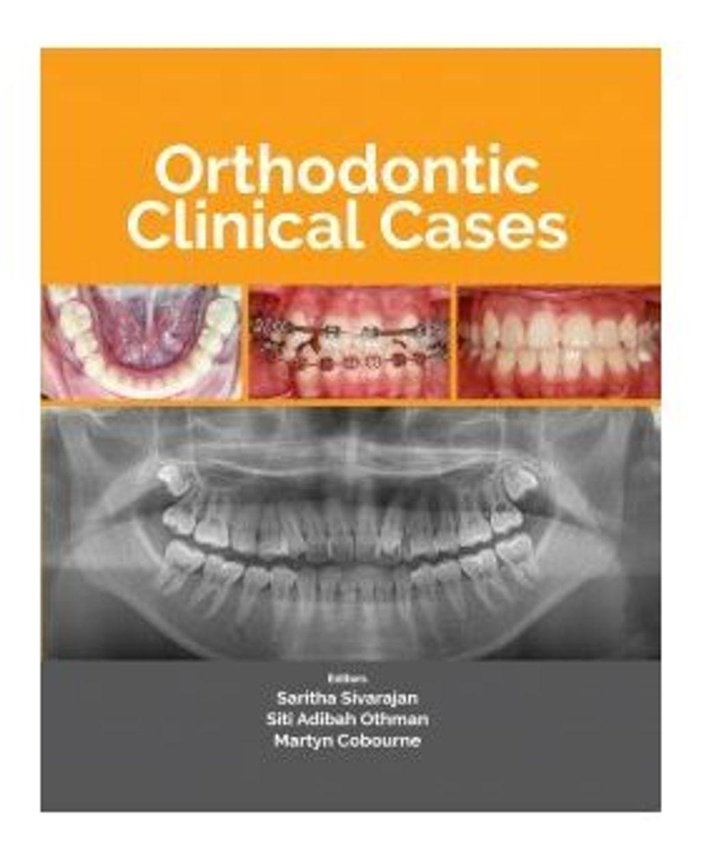 Orthodontic_Clinical_Case-305x305.jpg