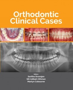 Orthodontic_Clinical_Case-305x305