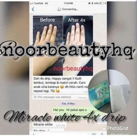 my-11134207-7rase-m70fr9dcf9151e