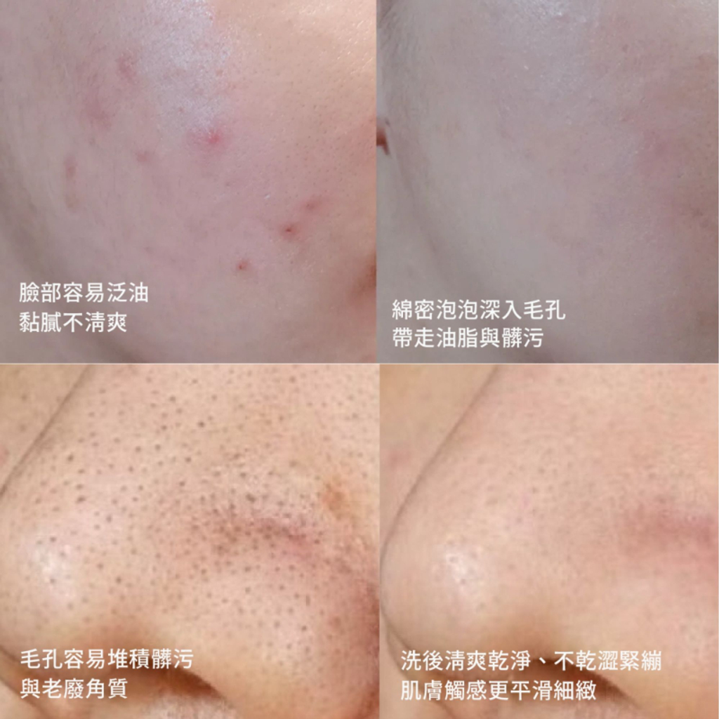 韓國OBgE 控油多合一洗卸慕斯200mL-8_0