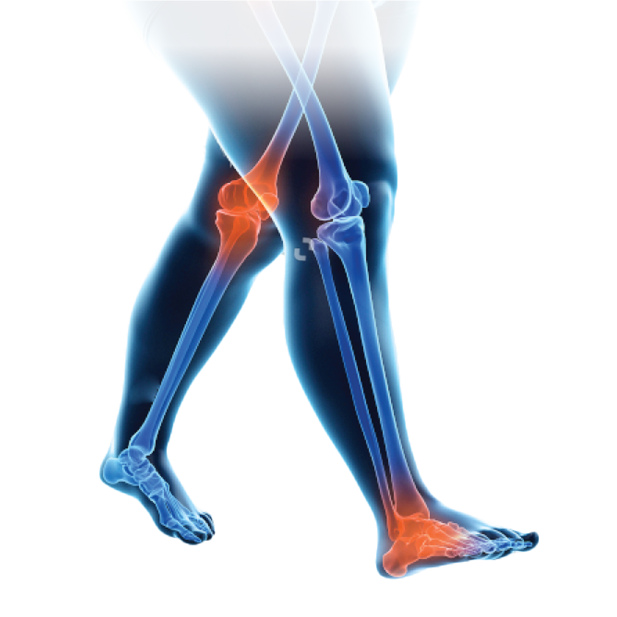 leg