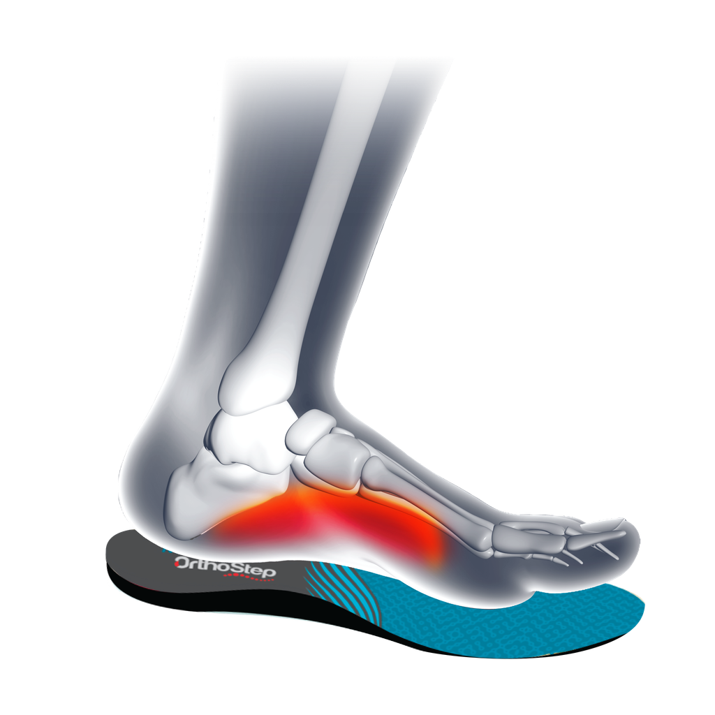 ortho step leg]