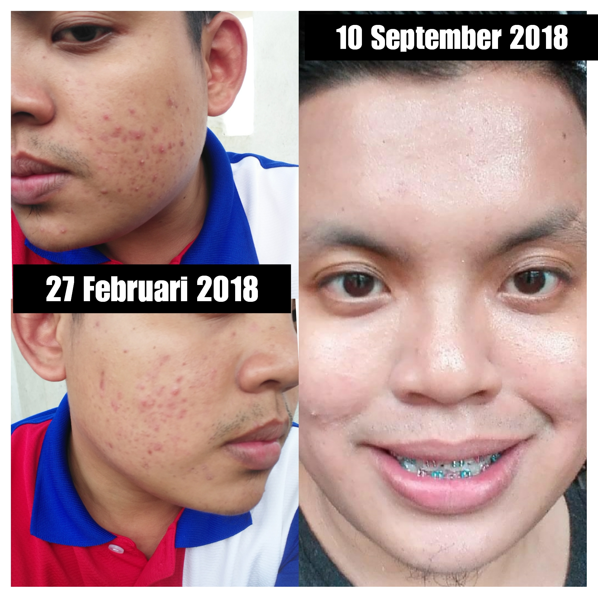 pinkboxcereal review before after.jpg