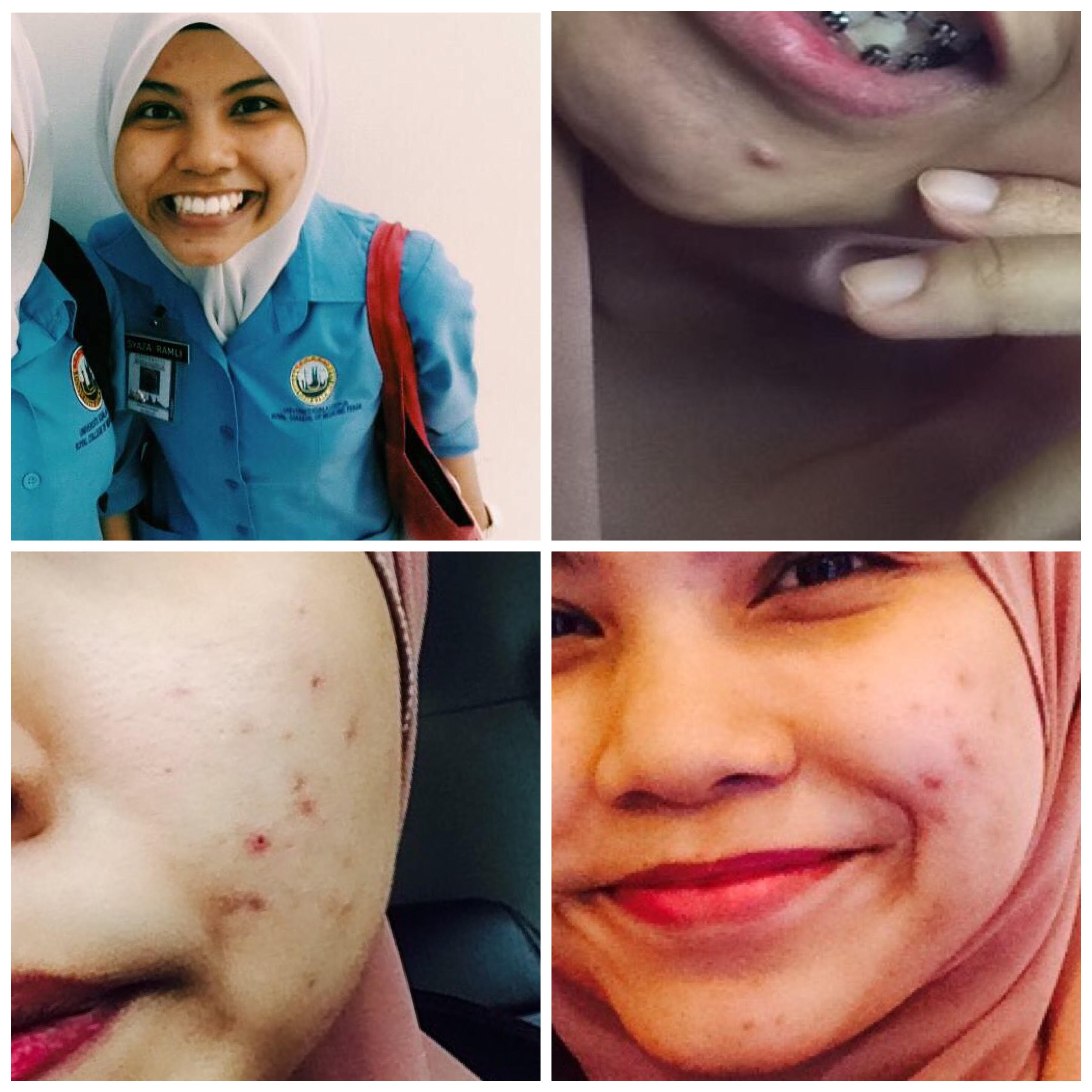 keburukan kone skincare