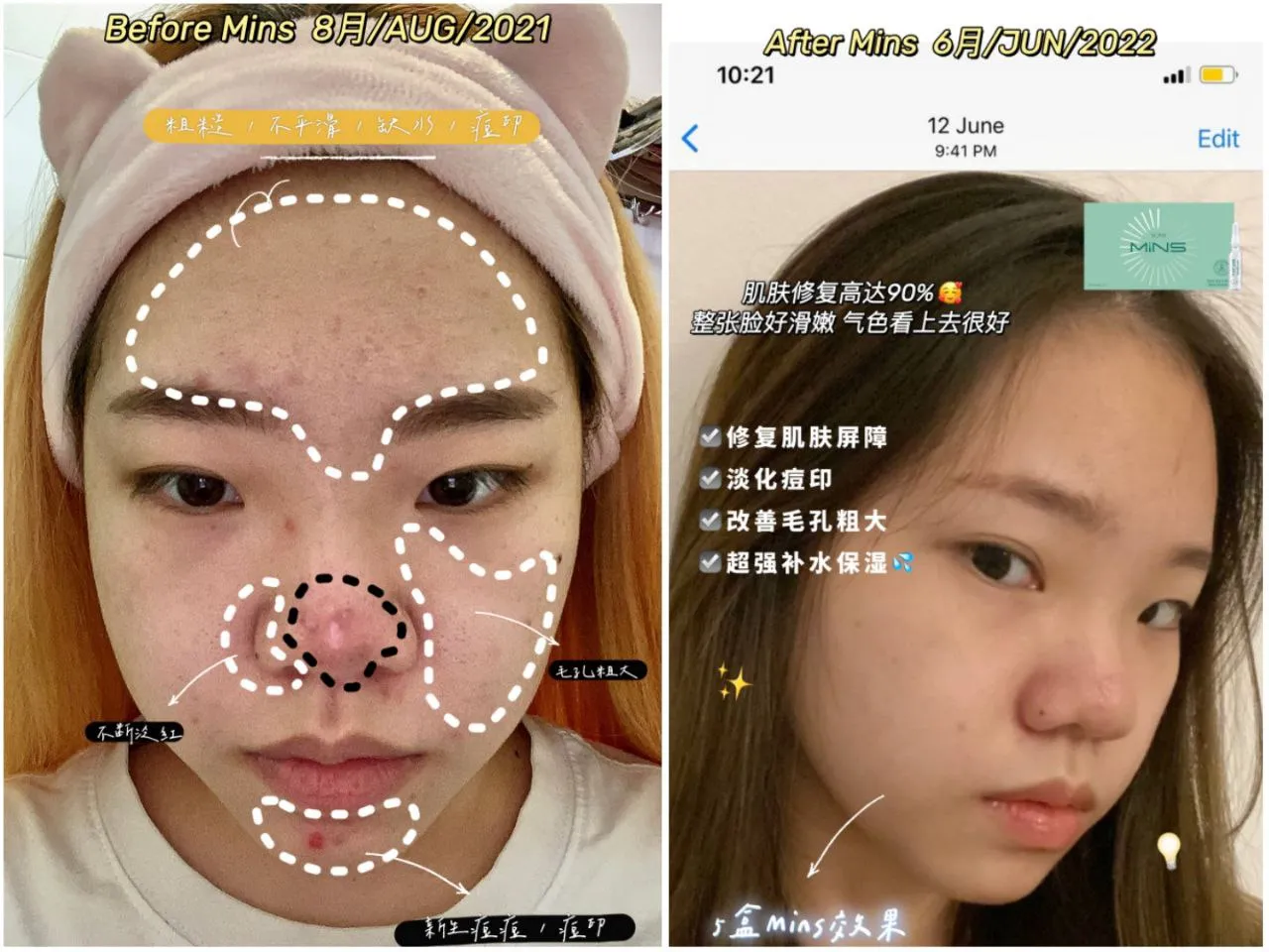 MINS皮肤问题解决方案对比图
