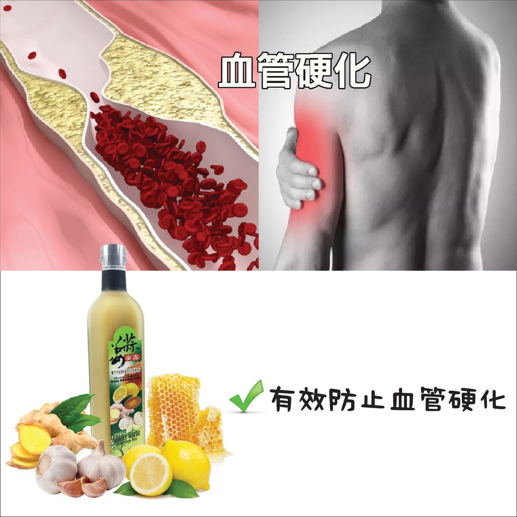 血管硬化-01.jpg