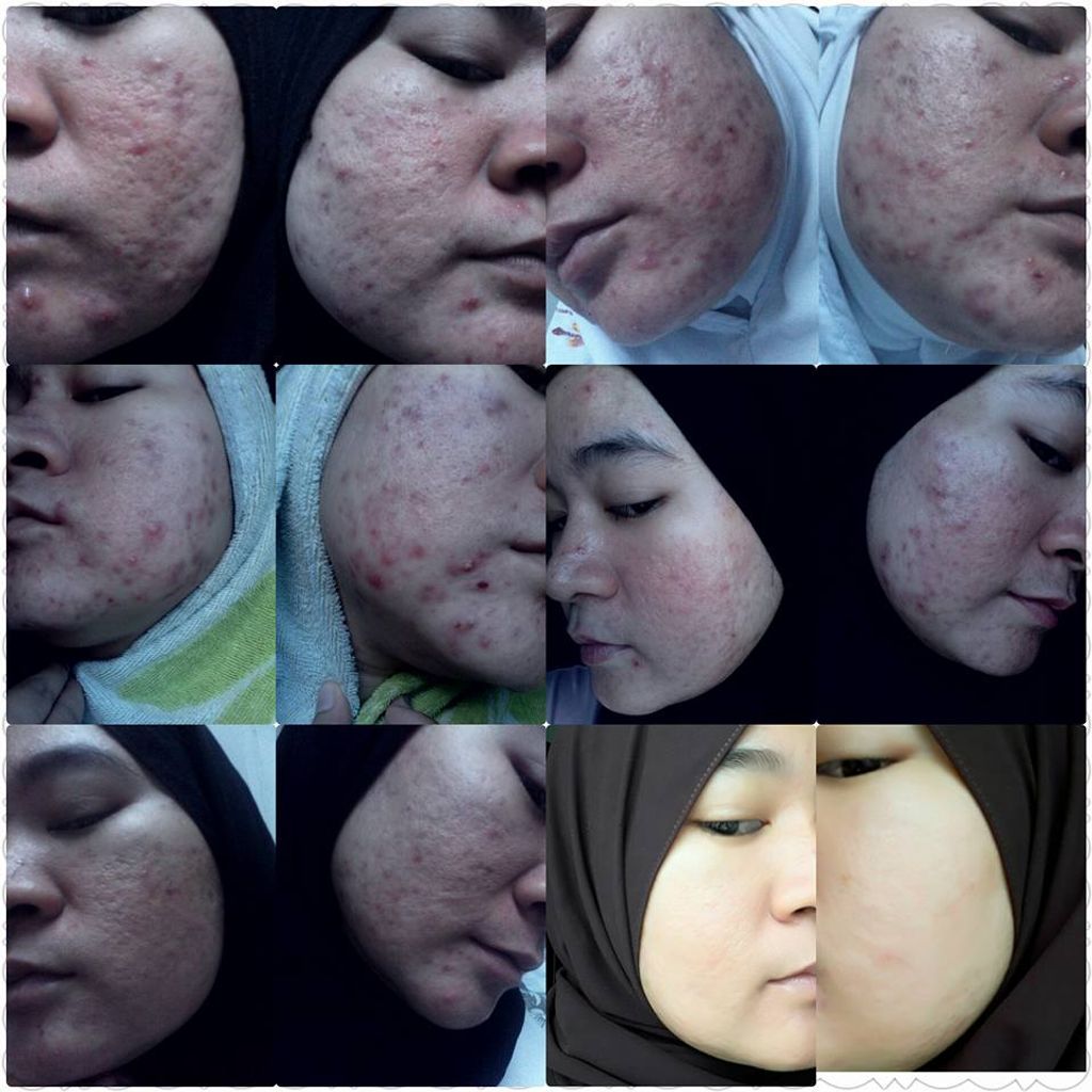 MASA DEPAN AKU BELUM BERAKHIR