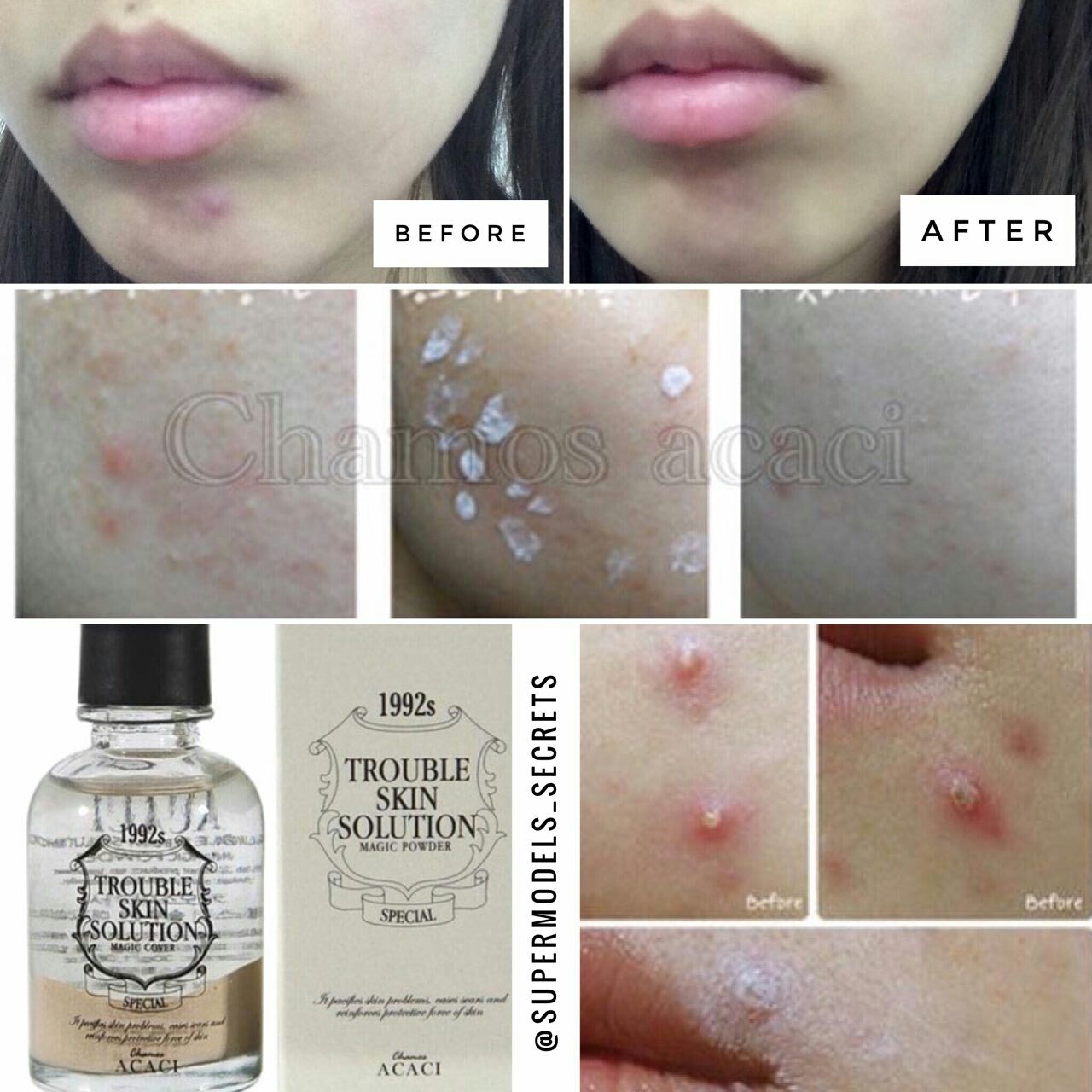 Trouble Skin Solution