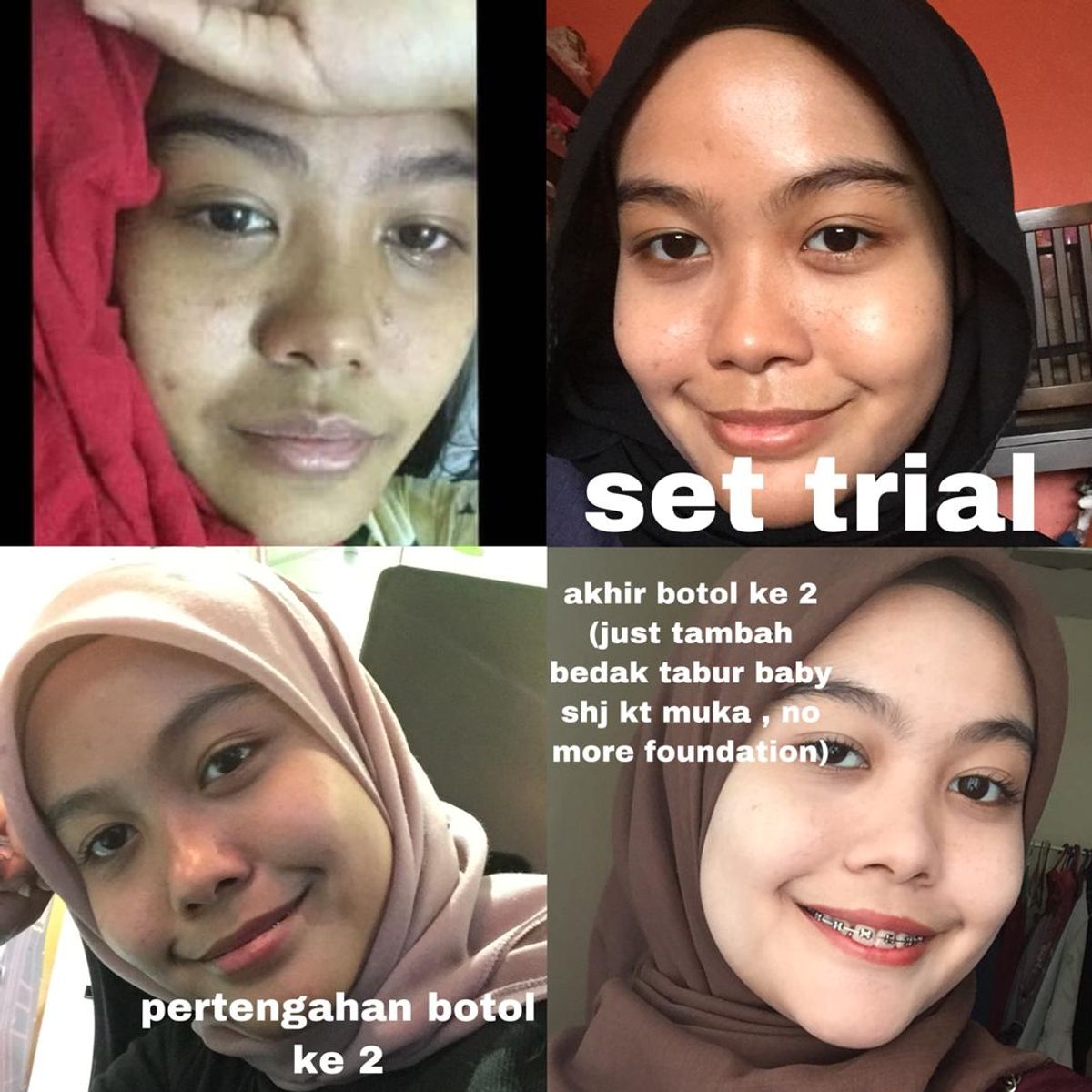Case 2 : Jerawat, Parut, Kusam