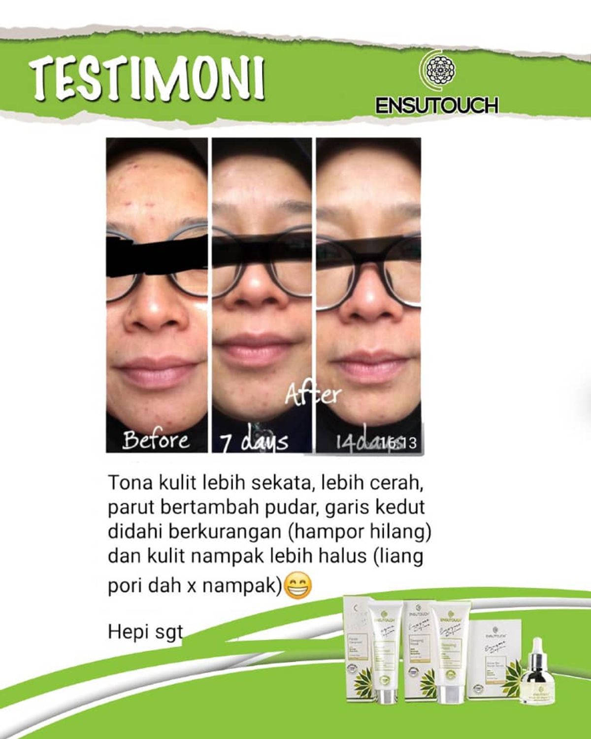 Case 7: Parut Pudar, Liang Roma Mengecil