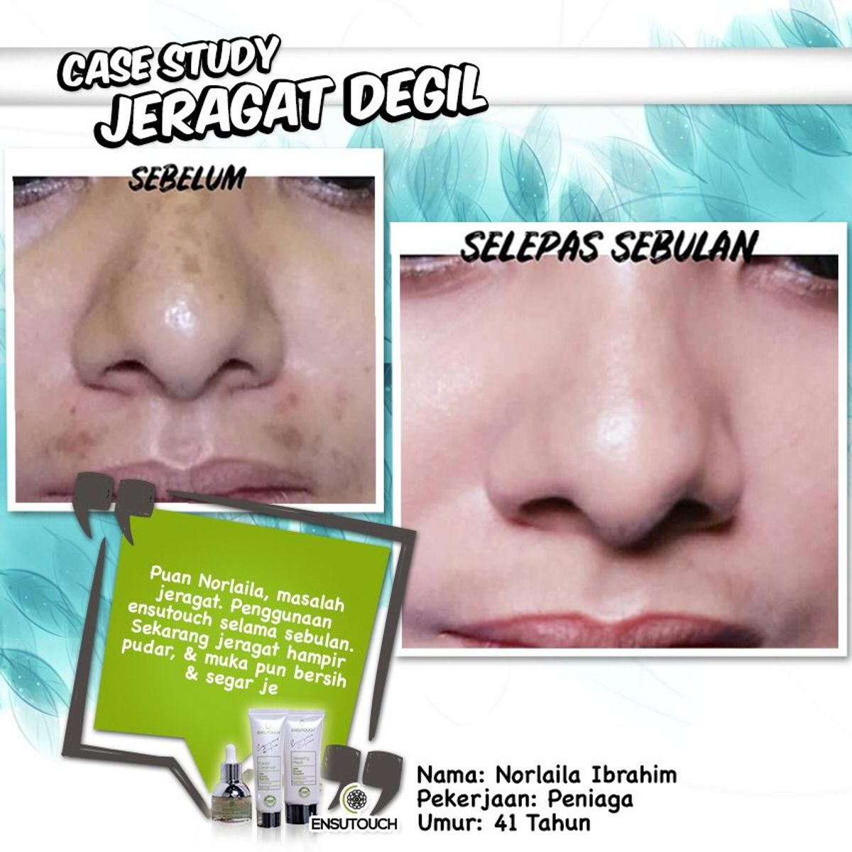 Case 8 : Jeragat Degil