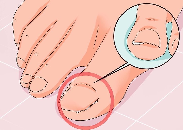 STOKIN KETAT PUNCA CAGU ? – Ammaira