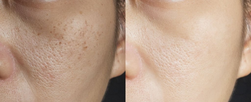 istockphoto-1298860783-1024x1024