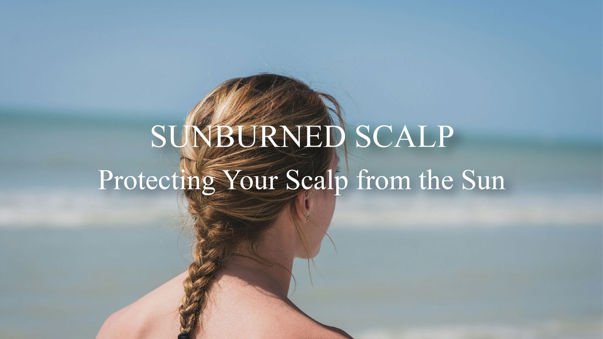 Sunburned Scalp: Protecting Your Scalp from the Sun