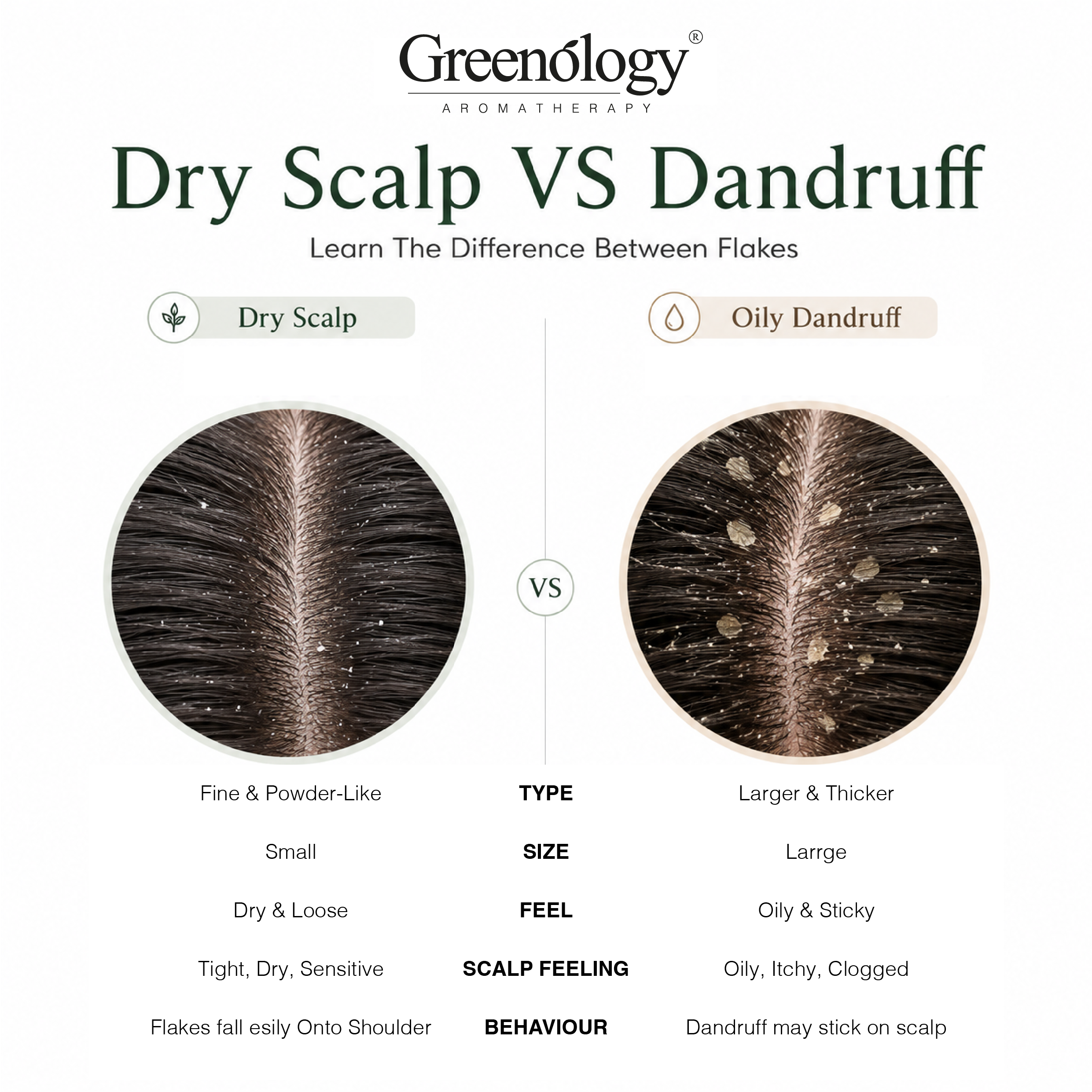 Comparison of dry scalp powder flakes and oily dandruff flakes