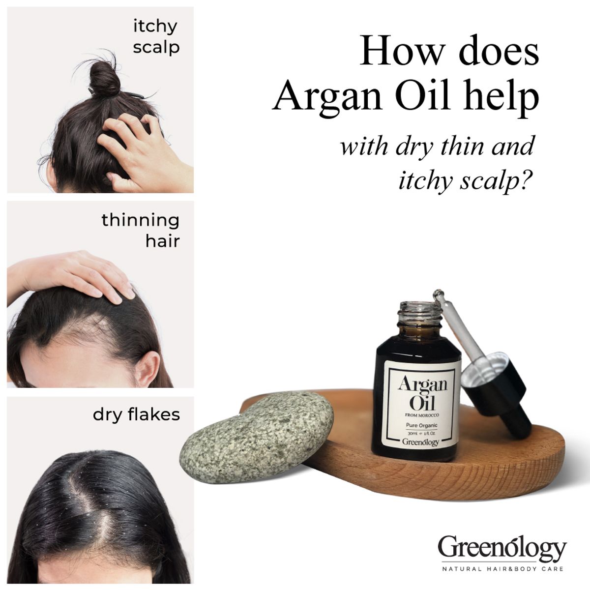 How does Argan Oil help with dry thin and itchy scalp?